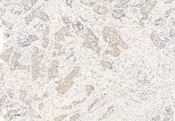 NCOA4 Polyclonal Antibody:Antibodies, Polyclonal