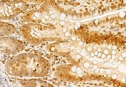 NCOA4 Polyclonal Antibody:Antibodies, Polyclonal