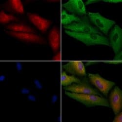 Invitrogen NDUFA1 Polyclonal Antibody 100 &mu;L; Unconjugated:Antibodies,