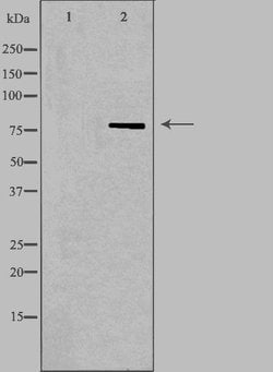 Invitrogen NDUFS1 Polyclonal Antibody 100 &mu;L; Unconjugated:Antibodies,