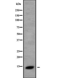 Invitrogen NDUFS6 Polyclonal Antibody 100 &mu;L | Buy Online | Invitrogen&trade; | Fisher Scientific