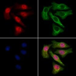 WHSC2 Polyclonal Antibody:Antibodies, Polyclonal