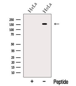 Invitrogen Neogenin Polyclonal Antibody 100 &mu;L; Unconjugated:Antibodies,