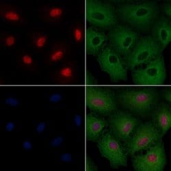 Invitrogen NeuN Polyclonal Antibody 100 &mu;L; Unconjugated:Antibodies,