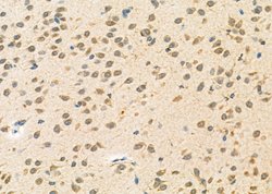 Invitrogen NEUROD4 Polyclonal Antibody 100 &mu;L | Buy Online | Invitrogen&trade; | Fisher Scientific