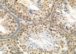 Invitrogen NEUROD4 Polyclonal Antibody 100 &mu;L | Buy Online | Invitrogen&trade; | Fisher Scientific