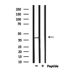 Invitrogen NEUROD4 Polyclonal Antibody 100 &mu;L | Buy Online | Invitrogen&trade; | Fisher Scientific