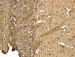 Invitrogen NF-H Polyclonal Antibody 100 &mu;L; Unconjugated:Antibodies,