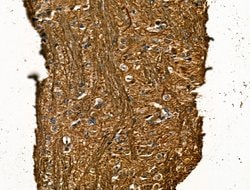 Invitrogen NF-H Polyclonal Antibody 100 &mu;L; Unconjugated:Antibodies,