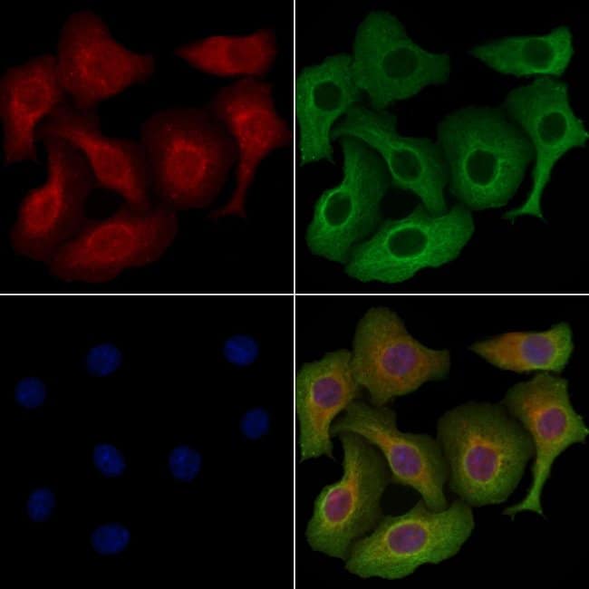 Invitrogen NNAT Polyclonal Antibody 100 μL | Buy Online