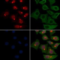 Invitrogen Neutrophil elastase Polyclonal Antibody 100 &mu;L; Unconjugated:Antibodies,