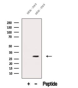 Invitrogen Neutrophil elastase Polyclonal Antibody 100 &mu;L; Unconjugated:Antibodies,