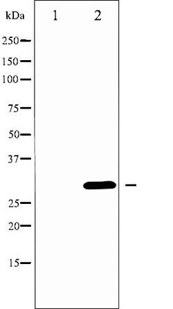 Invitrogen Neutrophil elastase Polyclonal Antibody 100 &mu;L; Unconjugated:Antibodies,