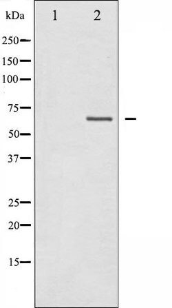 Invitrogen NF2 Polyclonal Antibody 100 &mu;L; Unconjugated:Antibodies,