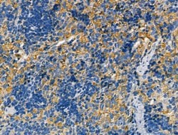 Invitrogen CHRNA7 Polyclonal Antibody 100 &mu;L; Unconjugated:Antibodies,