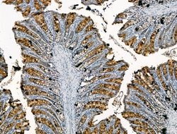 Invitrogen CHRNA7 Polyclonal Antibody 100 &mu;L; Unconjugated:Antibodies,