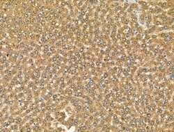 Invitrogen CHRNA7 Polyclonal Antibody 100 &mu;L; Unconjugated:Antibodies,