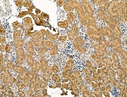 Invitrogen CHRNA7 Polyclonal Antibody 100 &mu;L; Unconjugated:Antibodies,