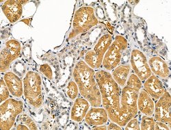 Invitrogen CHRNA7 Polyclonal Antibody 100 &mu;L; Unconjugated:Antibodies,
