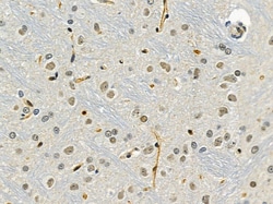 Invitrogen NIP7 Polyclonal Antibody 100 &mu;L; Unconjugated:Antibodies,