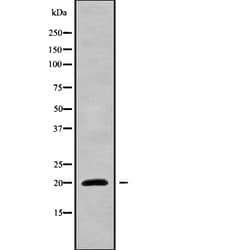 Invitrogen NIP7 Polyclonal Antibody 100 &mu;L; Unconjugated:Antibodies,