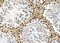 Invitrogen NKAP Polyclonal Antibody 100 &mu;L; Unconjugated:Antibodies,
