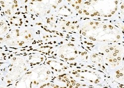 Invitrogen NKAP Polyclonal Antibody 100 &mu;L; Unconjugated:Antibodies,