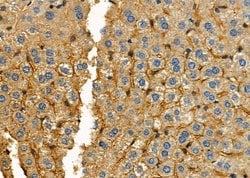 Invitrogen NKTR Polyclonal Antibody 100 &mu;L; Unconjugated:Antibodies,