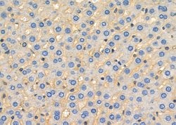 Invitrogen NKTR Polyclonal Antibody 100 &mu;L; Unconjugated:Antibodies,
