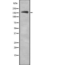 Invitrogen NKTR Polyclonal Antibody 100 &mu;L; Unconjugated:Antibodies,