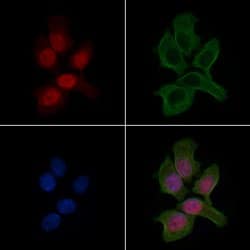 Invitrogen Nkx2.2 Polyclonal Antibody 100 &mu;L; Unconjugated:Antibodies,