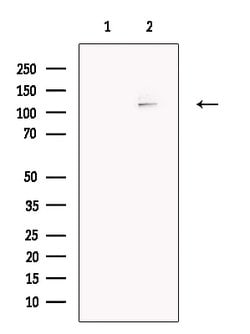 Invitrogen NOD3 Polyclonal Antibody 100 &mu;L; Unconjugated:Antibodies,