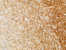Invitrogen NOD4 Polyclonal Antibody 100 μL; Unconjugated:Antibodies,