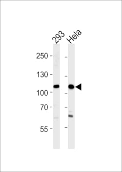 Invitrogen SALL4 Polyclonal Antibody 400 &mu;L | Buy Online | Invitrogen&trade; | Fisher Scientific