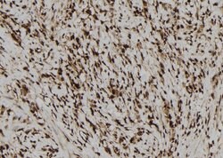 Invitrogen NLRP3 Polyclonal Antibody 100 &mu;L; Unconjugated:Antibodies,