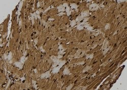 Invitrogen NLRP3 Polyclonal Antibody 100 &mu;L | Buy Online | Invitrogen&trade; | Fisher Scientific