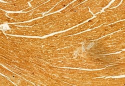 Invitrogen NLRP3 Polyclonal Antibody 100 &mu;L | Buy Online | Invitrogen&trade; | Fisher Scientific