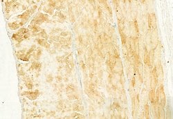 Invitrogen NLRP3 Polyclonal Antibody 100 &mu;L | Buy Online | Invitrogen&trade; | Fisher Scientific