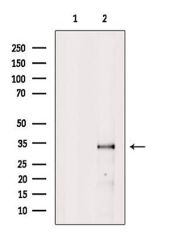 Invitrogen NMNAT2 Polyclonal Antibody 100 &mu;L; Unconjugated:Antibodies,