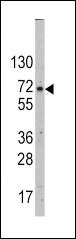 Invitrogen GLUT2 Polyclonal Antibody 400 &mu;L; Unconjugated:Antibodies,