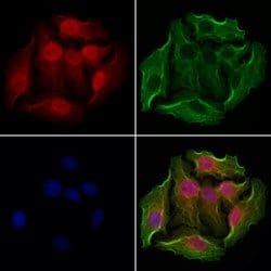 Invitrogen NSUN2 Polyclonal Antibody 100 &mu;L; Unconjugated:Antibodies,