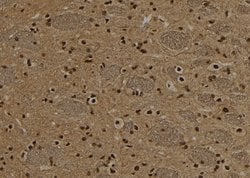 Invitrogen NSUN2 Polyclonal Antibody 100 &mu;L; Unconjugated:Antibodies,