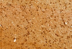 Invitrogen NSUN2 Polyclonal Antibody 100 &mu;L; Unconjugated:Antibodies,