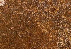 Invitrogen NSUN2 Polyclonal Antibody 100 &mu;L; Unconjugated:Antibodies,