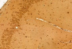 Invitrogen NSUN2 Polyclonal Antibody 100 &mu;L; Unconjugated:Antibodies,