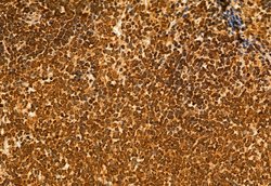 Invitrogen NSUN2 Polyclonal Antibody 100 &mu;L; Unconjugated:Antibodies,