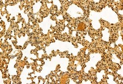 Invitrogen NSUN2 Polyclonal Antibody 100 &mu;L; Unconjugated:Antibodies,