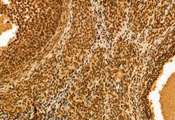 Invitrogen NSUN2 Polyclonal Antibody 100 &mu;L; Unconjugated:Antibodies,