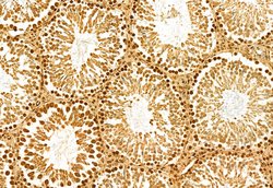 Invitrogen NSUN2 Polyclonal Antibody 100 &mu;L; Unconjugated:Antibodies,