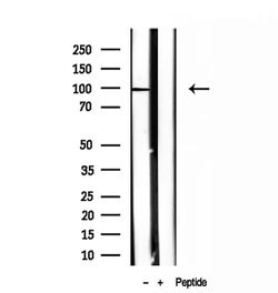Invitrogen NSUN2 Polyclonal Antibody 100 &mu;L; Unconjugated:Antibodies,